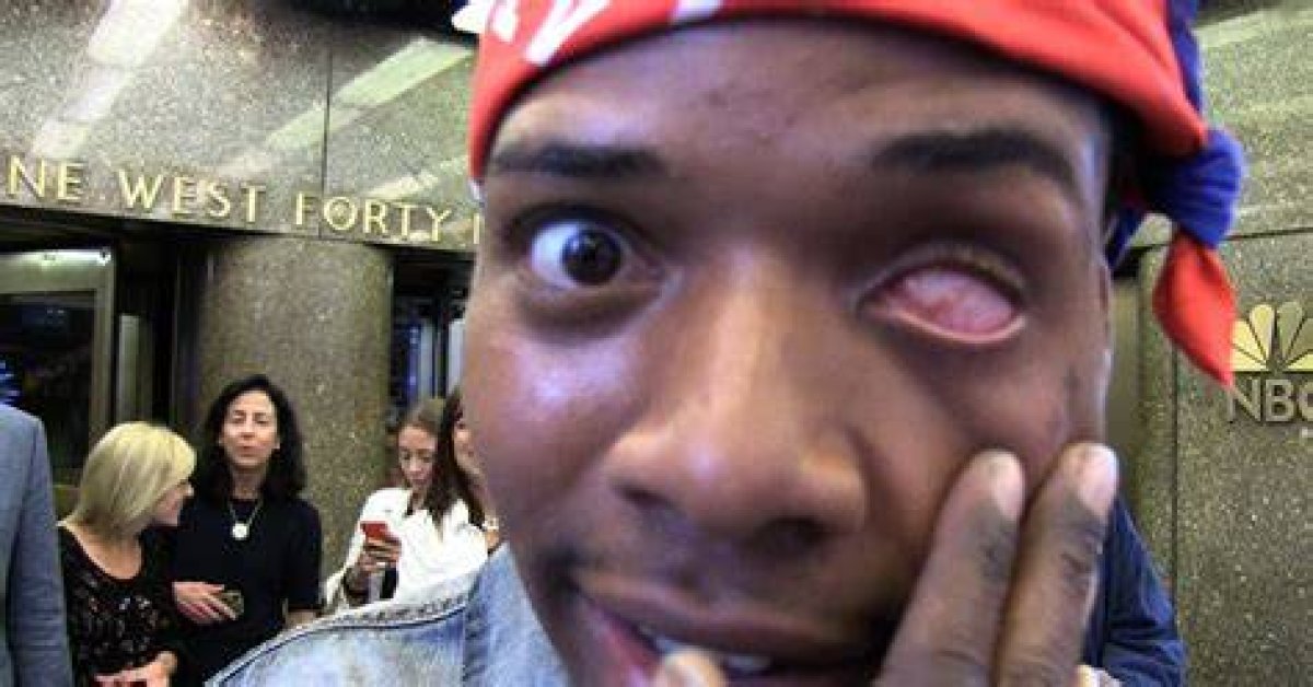 Fetty Wap's Left Eye: the Story Behind the Iconic Look